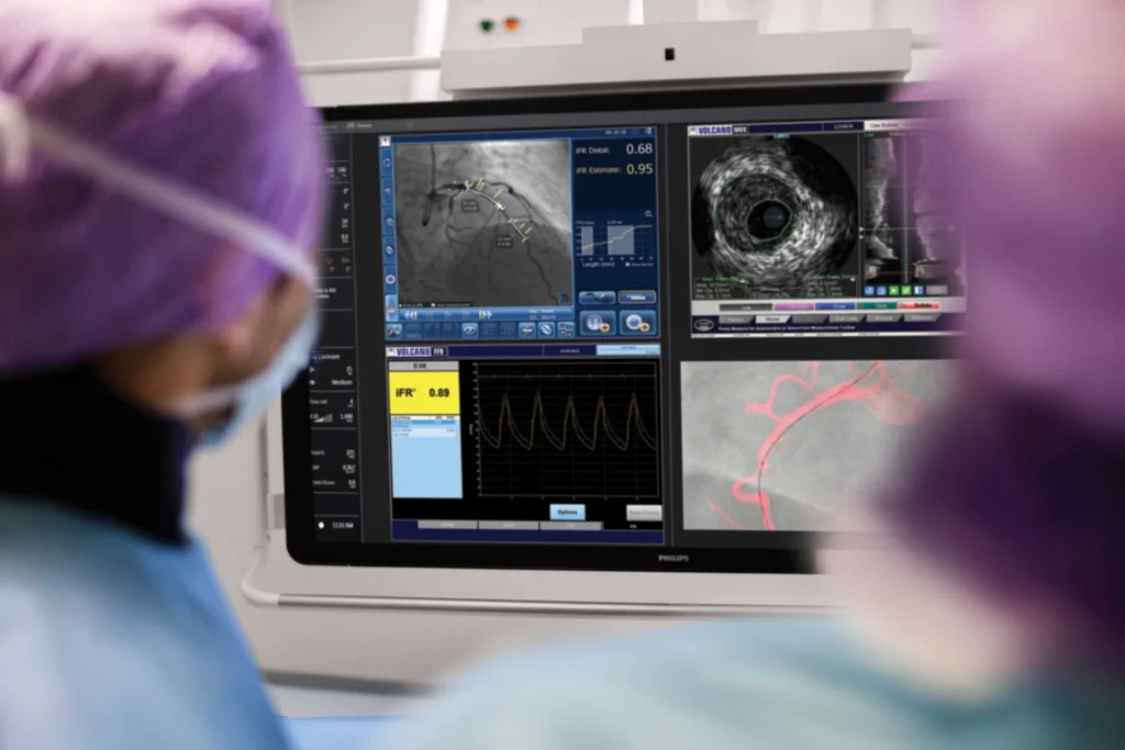 Intravascular Imaging in Pune