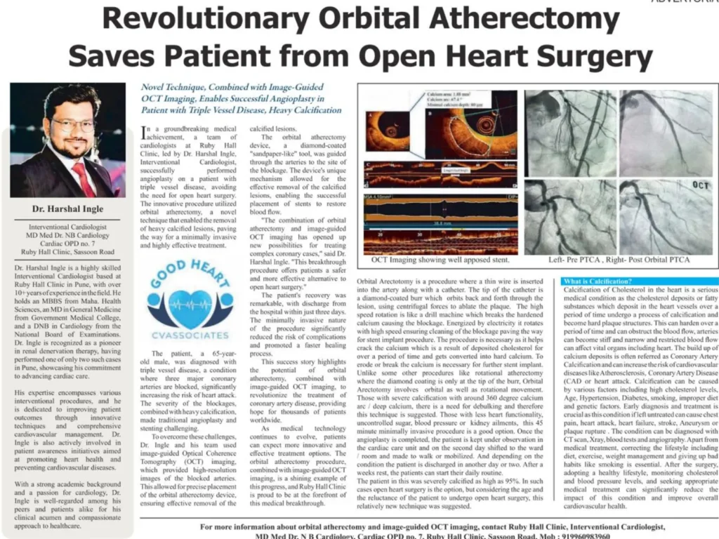 Revolutionary Orbital Atherectomy Saves Patient from Open Heart Surgery - Dr. Harshal Ingle Interventional Cardiologist MD Med Dr. NB Cardiology Ruby Hall Clinic.jpeg