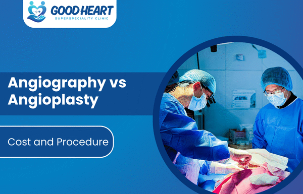 angiography vs angioplasty
