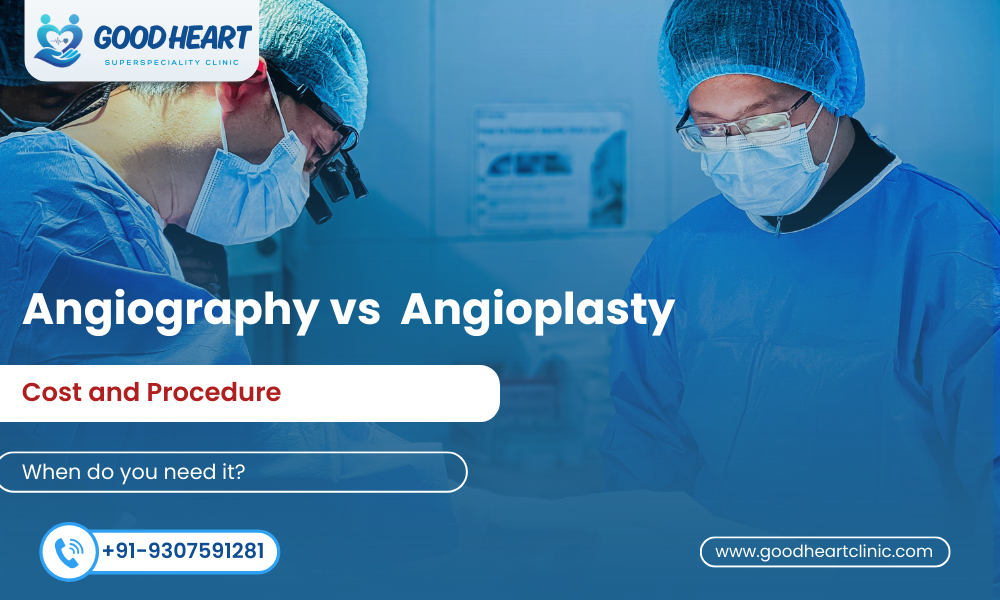 Angiography vs Angioplasty