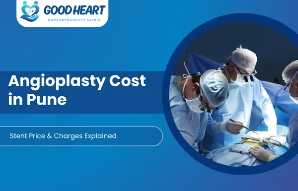 Angioplasty Cost