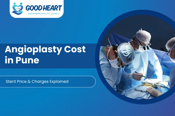 Angioplasty Cost