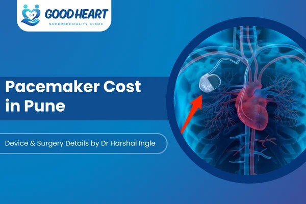 pacemaker cost