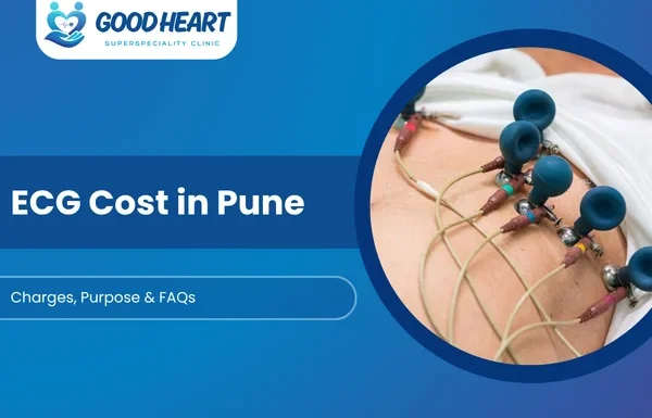 ECG Cost