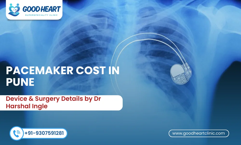 pacemaker cost in pune
