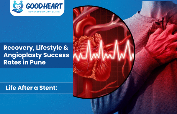 Life After a Stent: Recovery, Lifestyle & Angioplasty Success Rates in Pune