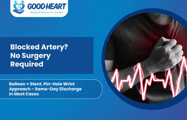 Clearing Heart Blocks: Advanced Coronary Angioplasty in Pune and Modern Stent Technologies