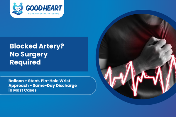 Clearing Heart Blocks: Advanced Coronary Angioplasty in Pune and Modern Stent Technologies