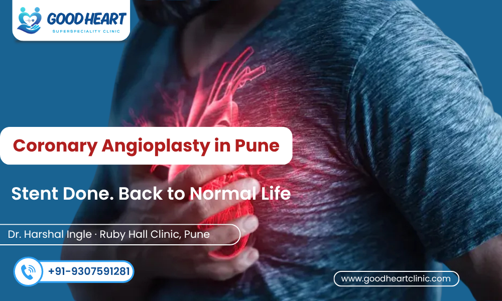 What Is Coronary Angioplasty — And What Does a Stent Actually Do?