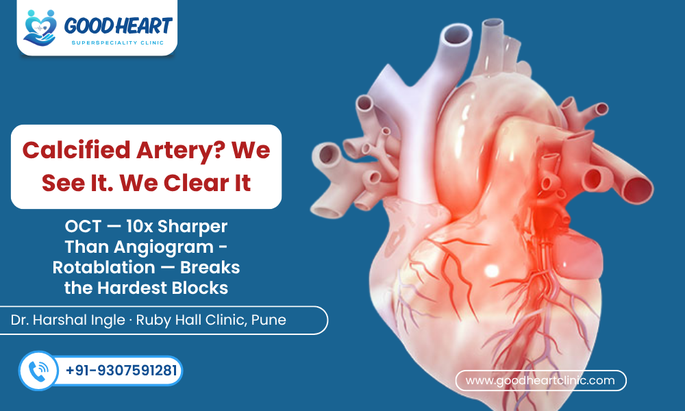Intravascular Treatments in Pune – IVUS OCT Imaging Calcified Blocks Good Heart Clinic