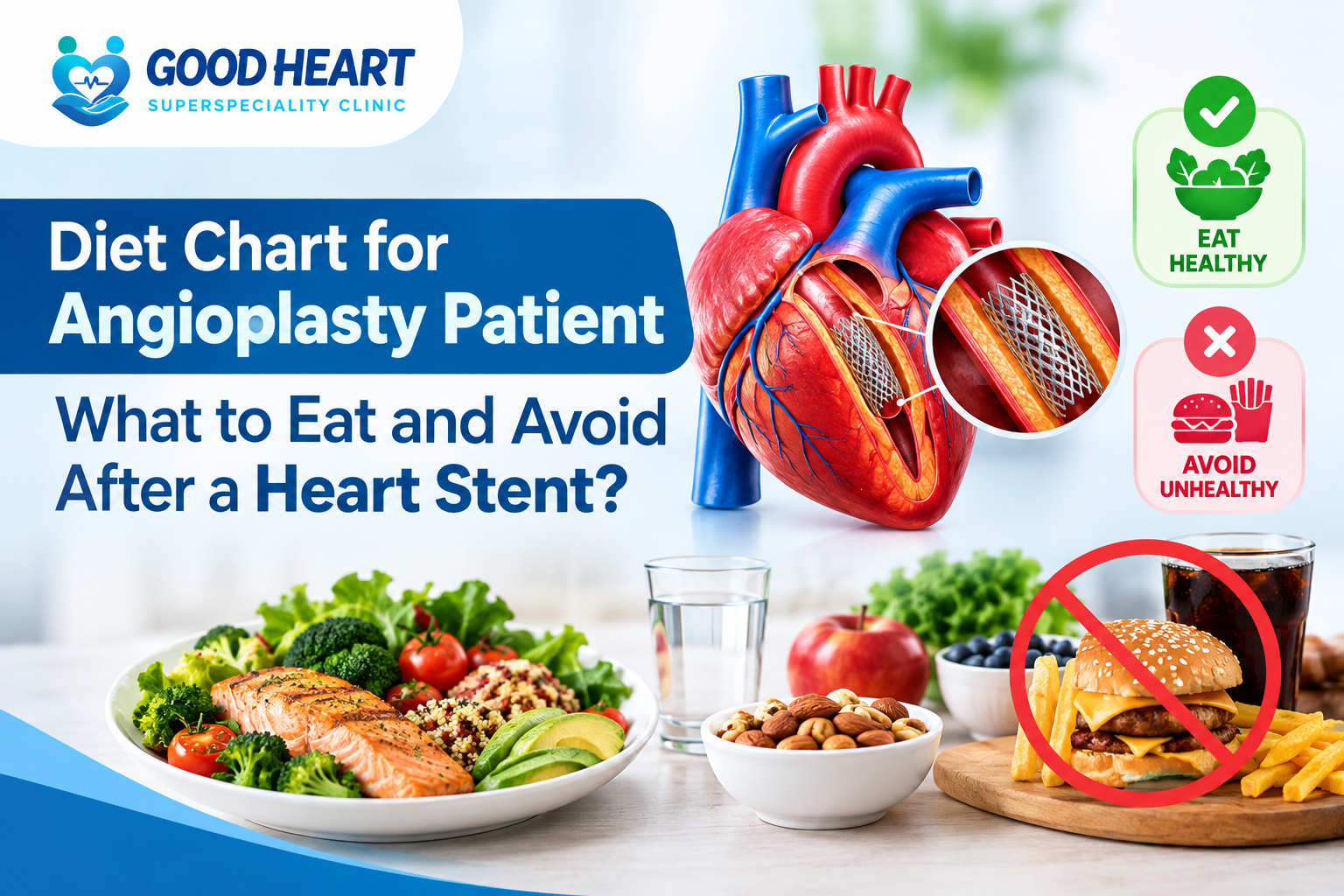 Diet Chart for Angioplasty Patient